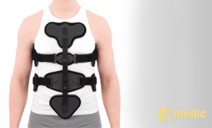 Modular Hyperextension Orthosis