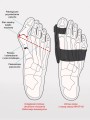 hallux-op-02-rysunek-630x840.jpg