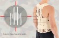 splints-1024x679.jpg